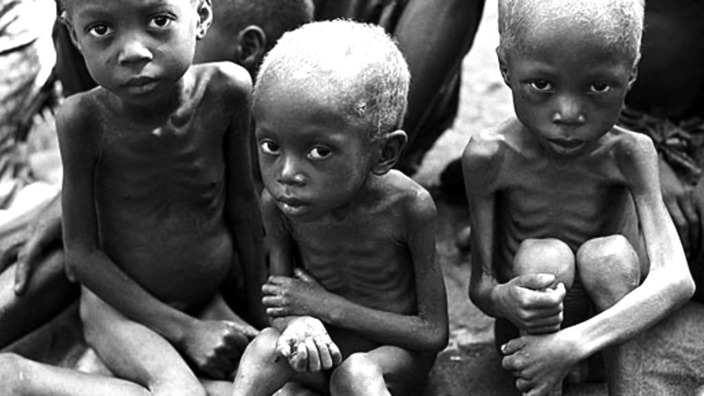 Resultado de imagem para fome infantil