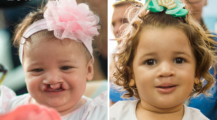 Operação Sorriso promove campanha para o Dia da Criança