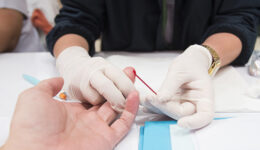 135 mil pessoas no Brasil vivem com HIV e não sabem