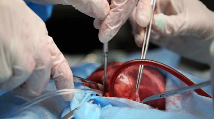 Com 304 doações, Rio de Janeiro bate recorde de transplantes de órgãos