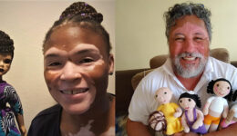 Bonecas com vitiligo ajudam crianças com a doença a se aceitarem
