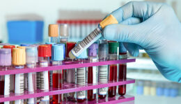 Exame de sangue pode detectar vários tipos de câncer precocemente