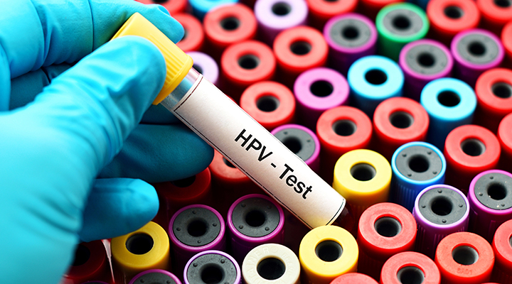 Blood for HPV test