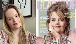Influencer com síndrome de Down se torna capa de revista na Holanda