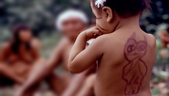 Crianças indígenas Yanomami estão morrendo sem tratamento médico