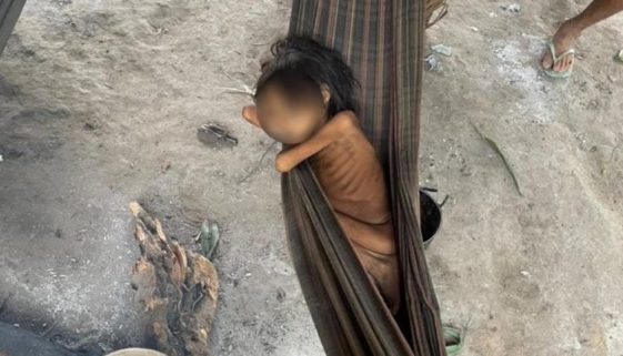 Foto de criança indígena Yanomami agonizando alertava o Brasil em 2021