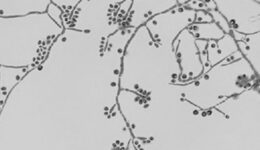 fungo Sporothrix