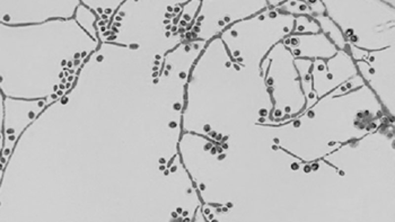 fungo Sporothrix
