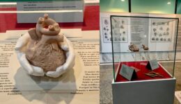 Instituto realiza exposição sobre as cardiopatias congênitas