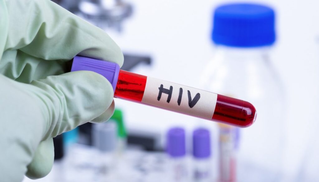 HIV